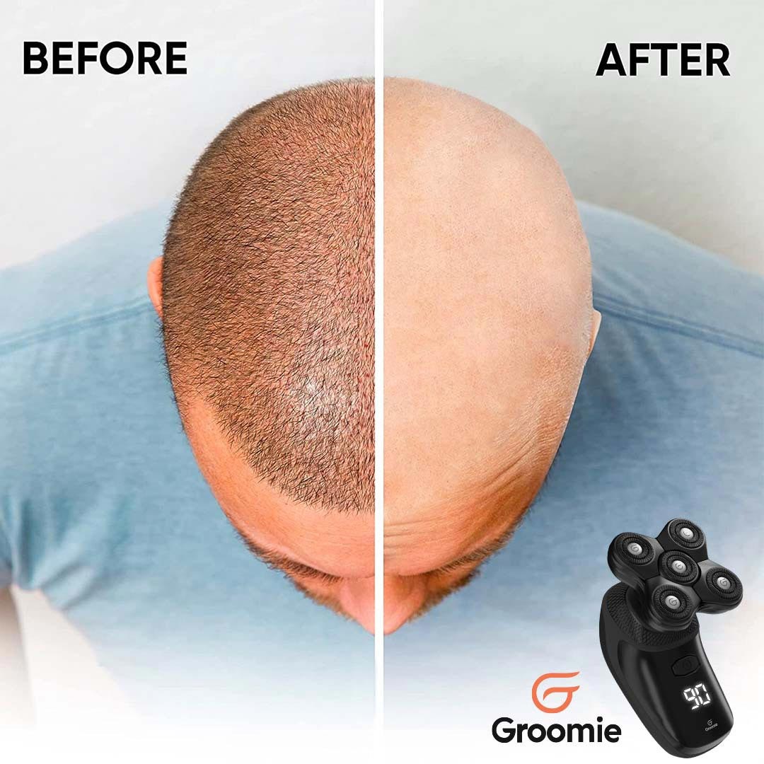 BaldiePro™ Head & Body Shaver Kit - Image 4